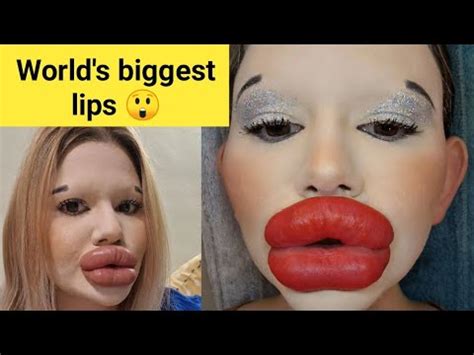 andrea ivanova|woman with world's largest lips.